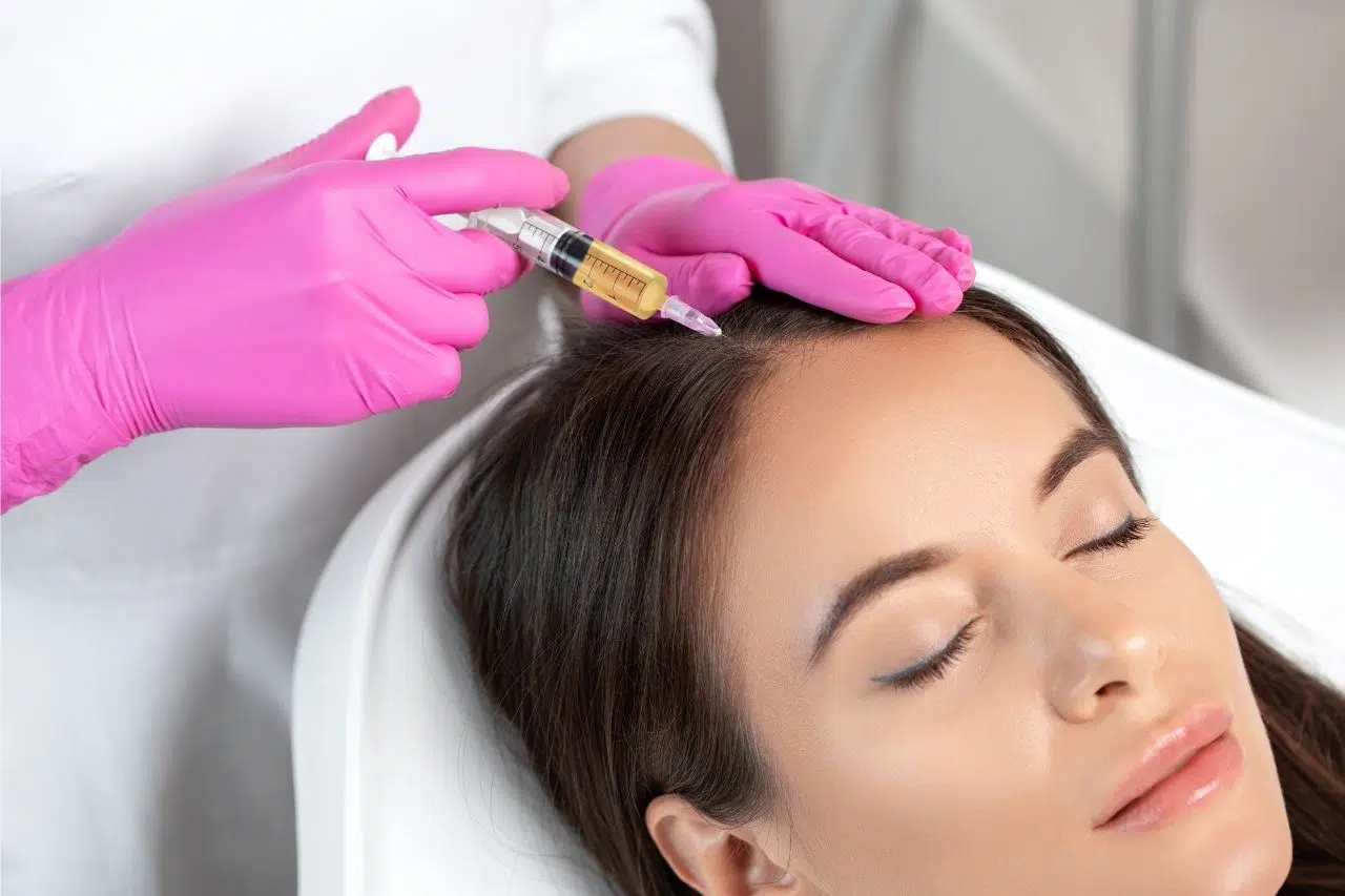 PRP Treatment for hair loss | Med Turkish