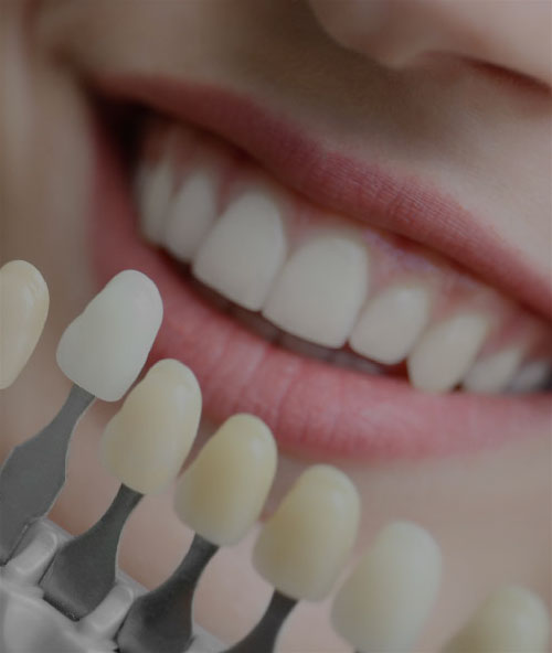 Periodontology ( Gum ) Treatment | Turkey | Med Turkish