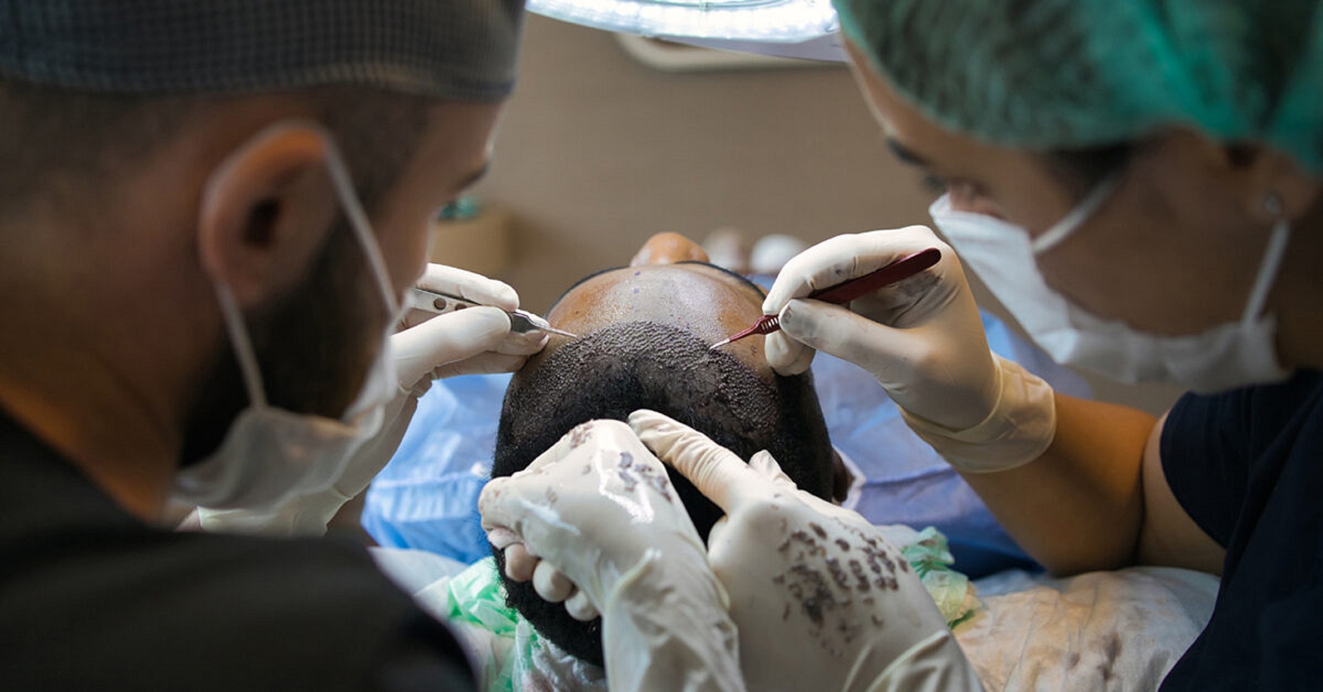 FUE Hair Transplant ( Implantation ) Treatment FUE Hair Transplant ( Implantation ) Treatment | Med Turkish