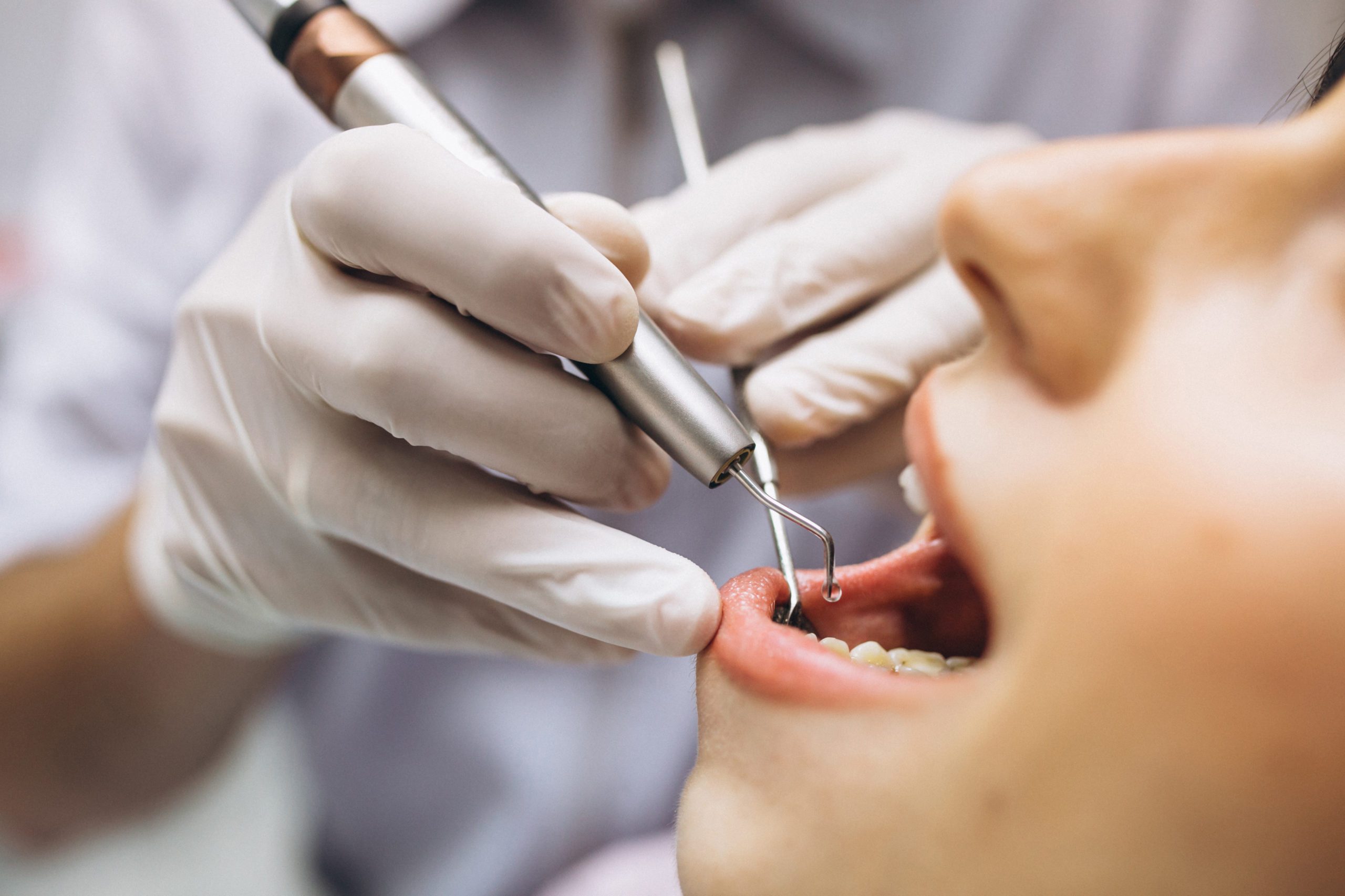 Tratamentul și procedurile de parodontologie | Turcia | Med Turkish